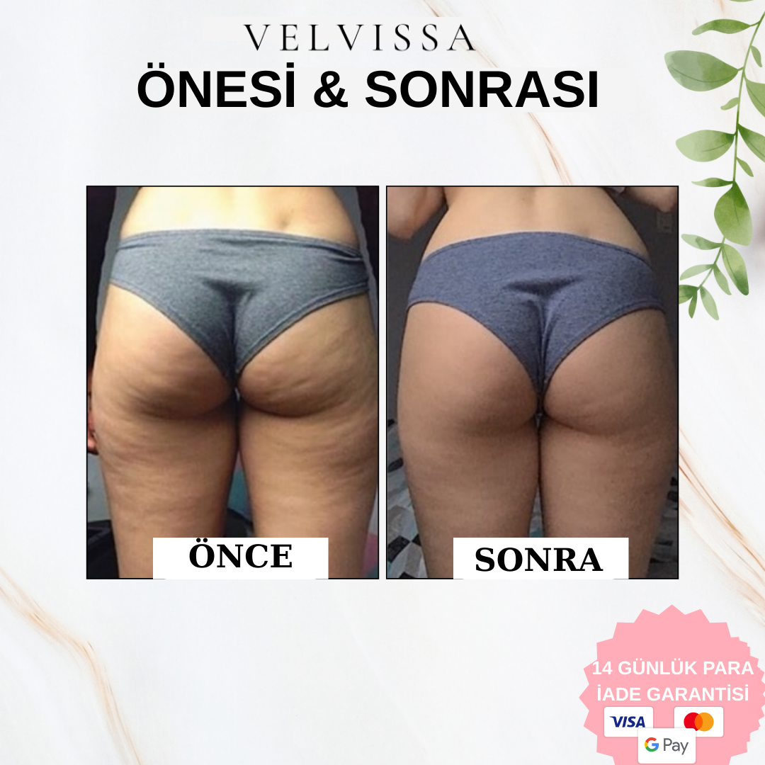 VELVİSSA™ VÜCUT GUA SHA TAŞI